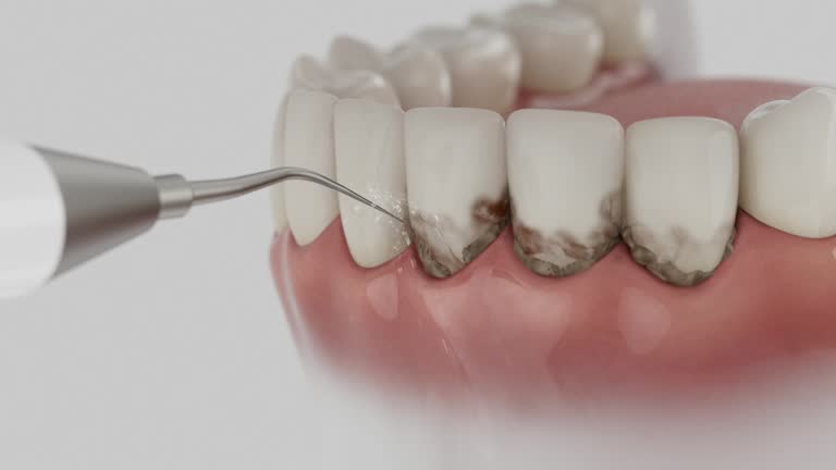 Trusted Wisdom Tooth Removal service in Brighton, TN - Dentist Open Now